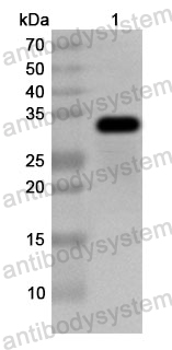 Anti-Human PPM1K Polyclonal Antibody