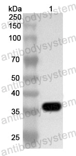 Anti-Human WDR18 Polyclonal Antibody