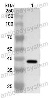 Anti-Human WSB1 Polyclonal Antibody