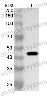 Anti-Human ARMC8 Polyclonal Antibody