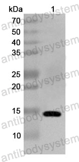 Anti-Human ZNF410 Polyclonal Antibody