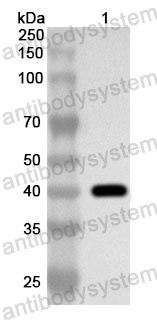 Anti-Human SAMM50 Polyclonal Antibody