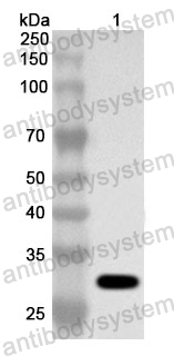 Anti-Human SENP1 Polyclonal Antibody