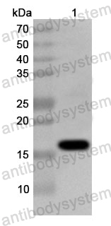 Anti-Human ARFGAP1 Polyclonal Antibody