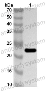 Anti-Human CDCA4 Polyclonal Antibody