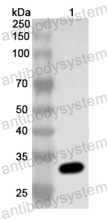 Anti-Human KIAA0319L Polyclonal Antibody