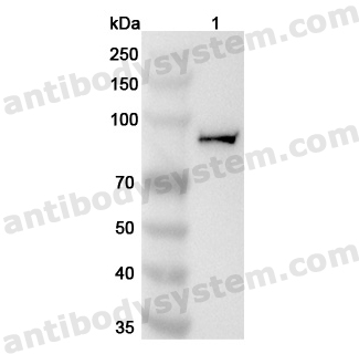 Anti-Human KIF2C Polyclonal Antibody