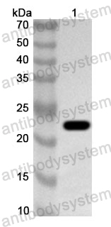 Anti-Human RBM8A Polyclonal Antibody