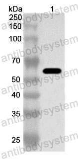 Anti-Human CCT7 Polyclonal Antibody