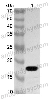 Anti-Human THRSP Polyclonal Antibody