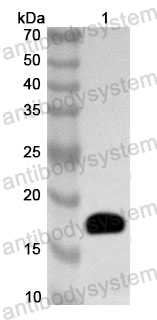 Anti-Human TTC7A Polyclonal Antibody