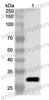 Anti-Human SRP68 Polyclonal Antibody