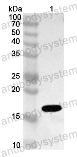 Anti-Human TRAPPC9 Polyclonal Antibody