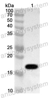 Anti-Human ARL2BP Polyclonal Antibody