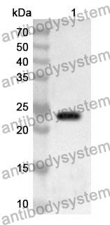 Anti-Human DDX20 Polyclonal Antibody