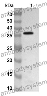 Anti-Human PARVB Polyclonal Antibody