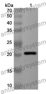 Anti-Human PIK3R5 Polyclonal Antibody