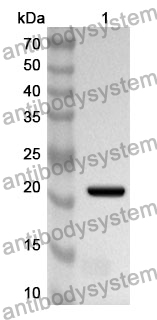 Anti-Human PICK1 Polyclonal Antibody