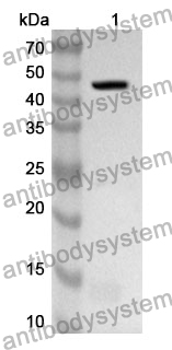 Anti-Human PIP5K1A Polyclonal Antibody