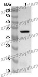 Anti-Human PRPF8 Polyclonal Antibody