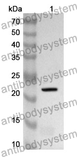 Anti-Human GINS2 Polyclonal Antibody