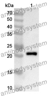 Anti-Human RNF20 Polyclonal Antibody