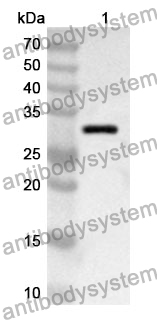 Anti-Human SMARCD1 Polyclonal Antibody