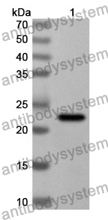 Anti-Human HPS5 Polyclonal Antibody