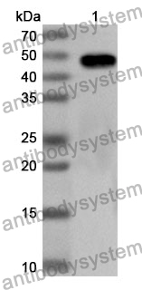 Anti-Human NSUN5 Polyclonal Antibody