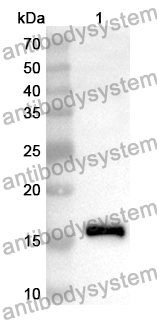 Anti-Human PHF11 Polyclonal Antibody