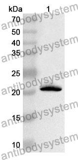 Anti-Human PIH1D1 Polyclonal Antibody