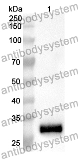 Anti-Human PIKFYVE Polyclonal Antibody