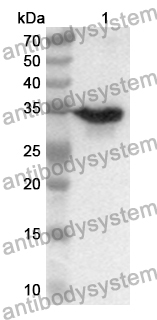 Anti-Human PRICKLE1 Polyclonal Antibody