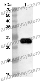 Anti-Human ARHGEF1 Polyclonal Antibody