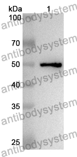 Anti-Human ERAP1 Polyclonal Antibody