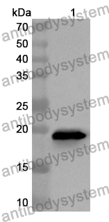 Anti-Human ASF1A Polyclonal Antibody