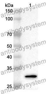 Anti-Human ATP6V1D Polyclonal Antibody