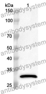 Anti-Human BBS2 Polyclonal Antibody