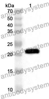 Anti-Human EIF4E3 Polyclonal Antibody