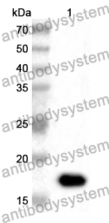 Anti-Human EIF5A2 Polyclonal Antibody