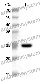 Anti-Human NDUFA13 Polyclonal Antibody