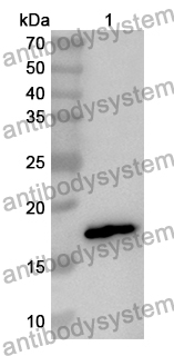 Anti-Human AIDA Polyclonal Antibody