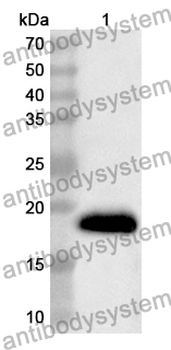 Anti-Human RGS17 Polyclonal Antibody