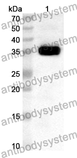 Anti-Human ALKBH4 Polyclonal Antibody