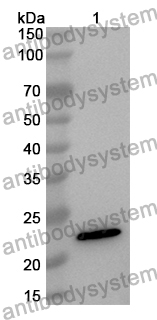 Anti-Human RBM24 Polyclonal Antibody