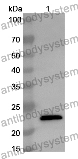 Anti-Human RBPMS Polyclonal Antibody