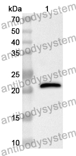 Anti-Human STEAP3 Polyclonal Antibody