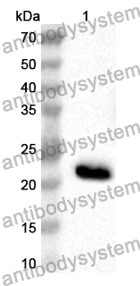 Anti-Human TMOD4 Polyclonal Antibody