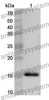 Anti-Human TXNDC5 Polyclonal Antibody