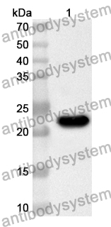 Anti-Human VAMP8 Polyclonal Antibody